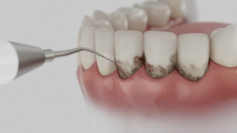 Reliable Emergency Dentist contractor in Laurel Bay, SC by Smile Center Dentistry